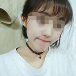 做完埋線提升后，松弛的臉蛋拜拜了