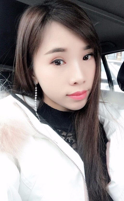 楊海平雙眼皮手術案例