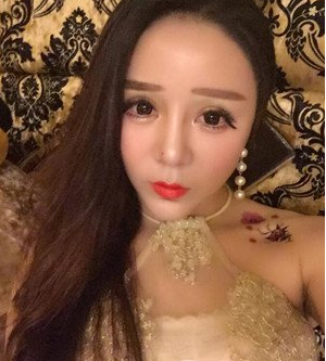 深圳南西子黃藝做自體脂肪隆胸案例效果對(duì)比圖