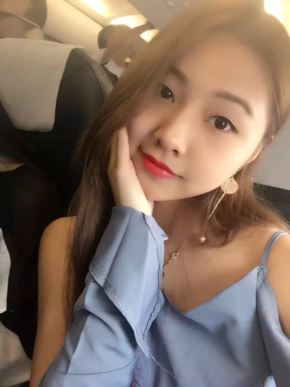 整形醫(yī)生徐長亮做切開雙眼皮案例效果對比圖 整形醫(yī)生徐長亮做切開雙眼皮案例效果對比圖