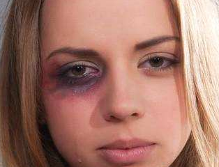 長沙愛思特醫(yī)療美容醫(yī)院激光去黑眼圈