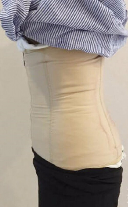 合肥壹加壹整形醫(yī)生周福田做腰腹吸脂技術(shù)怎么樣？附腰腹吸脂案例