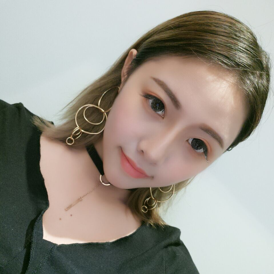 整形醫(yī)生徐長亮做切開雙眼皮案例效果對比圖 整形醫(yī)生徐長亮做切開雙眼皮案例效果對比圖