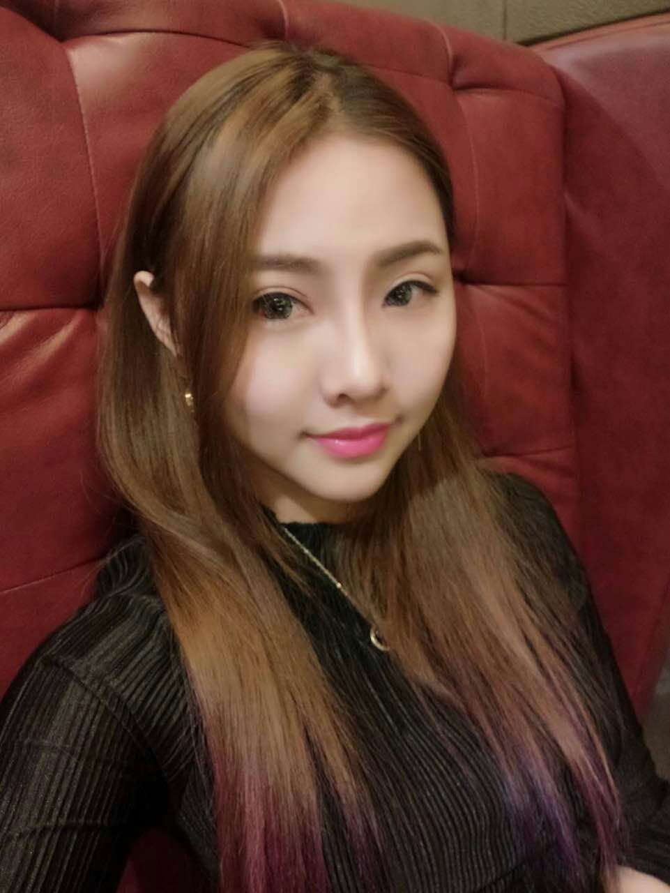 整形醫(yī)生徐長亮做切開雙眼皮案例效果對比圖 整形醫(yī)生徐長亮做切開雙眼皮案例效果對比圖