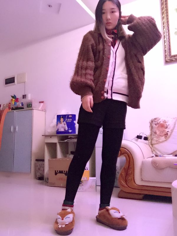 成都美立方整形醫(yī)院黃華醫(yī)生做大腿吸脂怎么樣？附大腿吸脂案例