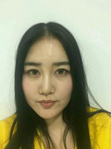 漢中韓美整形醫(yī)生常雙模假體隆鼻+耳軟骨墊鼻尖真實案例效果圖 漢中韓美整形醫(yī)生常雙模假體隆鼻+耳軟骨墊鼻尖真實案例效果圖