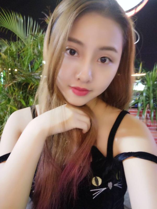 整形醫(yī)生徐長亮做切開雙眼皮案例效果對比圖 整形醫(yī)生徐長亮做切開雙眼皮案例效果對比圖