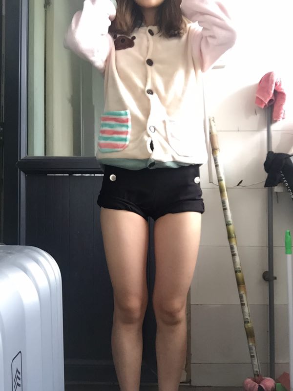 成都美立方整形醫(yī)院黃華醫(yī)生做大腿吸脂怎么樣？附大腿吸脂案例