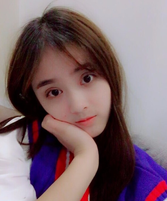 福州愛美爾整形黃林勝雙眼皮案例效果對比圖 福州愛美爾整形黃林勝雙眼皮案例效果對比圖