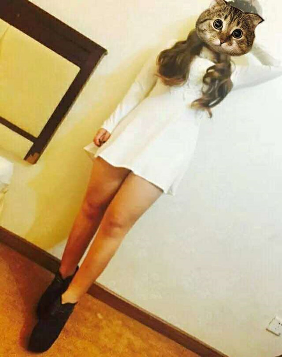 廣州軍頤醫(yī)院整形美容中心石建薇醫(yī)生腰腹吸脂真實(shí)案例對(duì)比圖 廣州軍頤醫(yī)院整形美容中心石建薇醫(yī)生腰腹吸脂真實(shí)案例對(duì)比圖