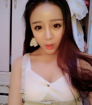 深圳南西子黃藝做自體脂肪隆胸案例效果對(duì)比圖