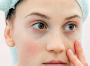 鄭州安格潤醫(yī)療美容門診部激光去黑眼圈