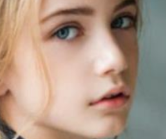 珠海愛(ài)思特醫(yī)療美容醫(yī)院雙眼皮修復(fù)