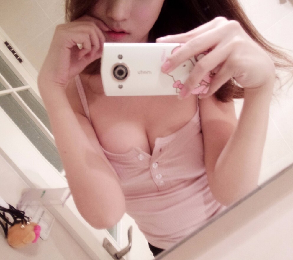 鄭州麗天整形美容醫(yī)院范巨峰醫(yī)生做假體+自體脂肪隆胸效果怎么樣?附真人案例