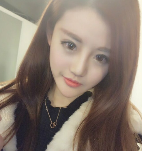 下頜角磨骨八個月后