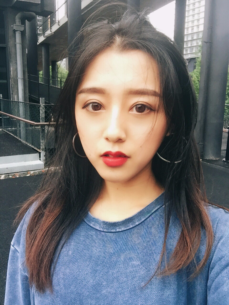 西安米蘭柏羽整形醫(yī)院李旭平做切開雙眼皮效果怎么樣？附案例