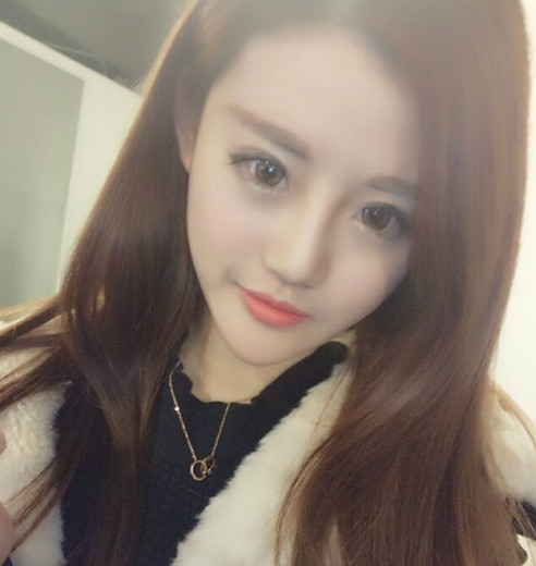 深圳鵬愛整形醫(yī)院湯月碧醫(yī)生做下頜角磨骨怎么樣？附下頜角磨骨案例