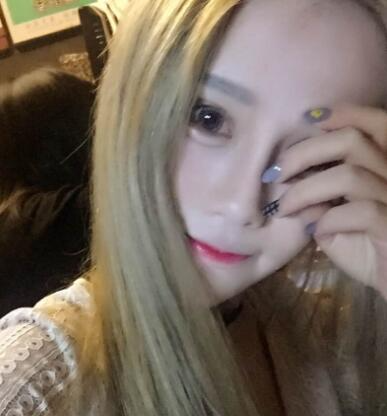 長春奧拉克美容醫(yī)院金相勛醫(yī)生做玻尿酸豐臥蠶怎么樣？附案例