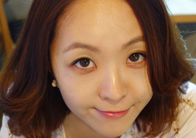 徐州時(shí)光洪揚(yáng)醫(yī)療美容診所宮昔愿醫(yī)生做激光祛斑效果怎么樣？