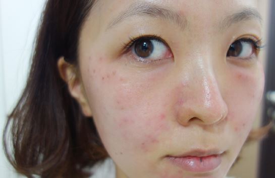 徐州時(shí)光洪揚(yáng)醫(yī)療美容診所宮昔愿醫(yī)生做激光祛斑效果怎么樣？