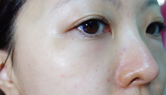 徐州時(shí)光洪揚(yáng)醫(yī)療美容診所宮昔愿醫(yī)生做激光祛斑效果怎么樣？