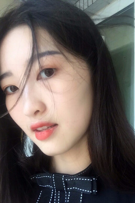 鄭州正合口腔門診部做牙齒矯正怎么樣？附郭毅醫(yī)生牙齒金屬托槽矯正案例