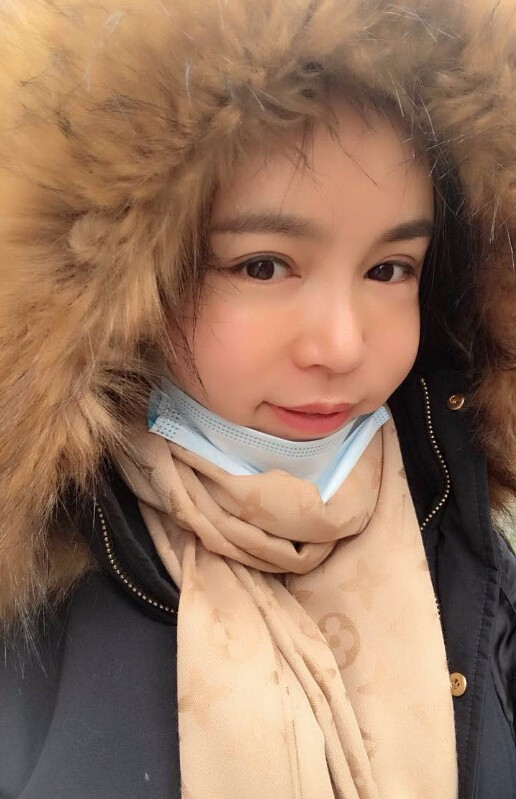 重慶聯(lián)合麗格美容醫(yī)院林麗蓉醫(yī)生做自體脂肪豐蘋果肌怎么樣？附案例