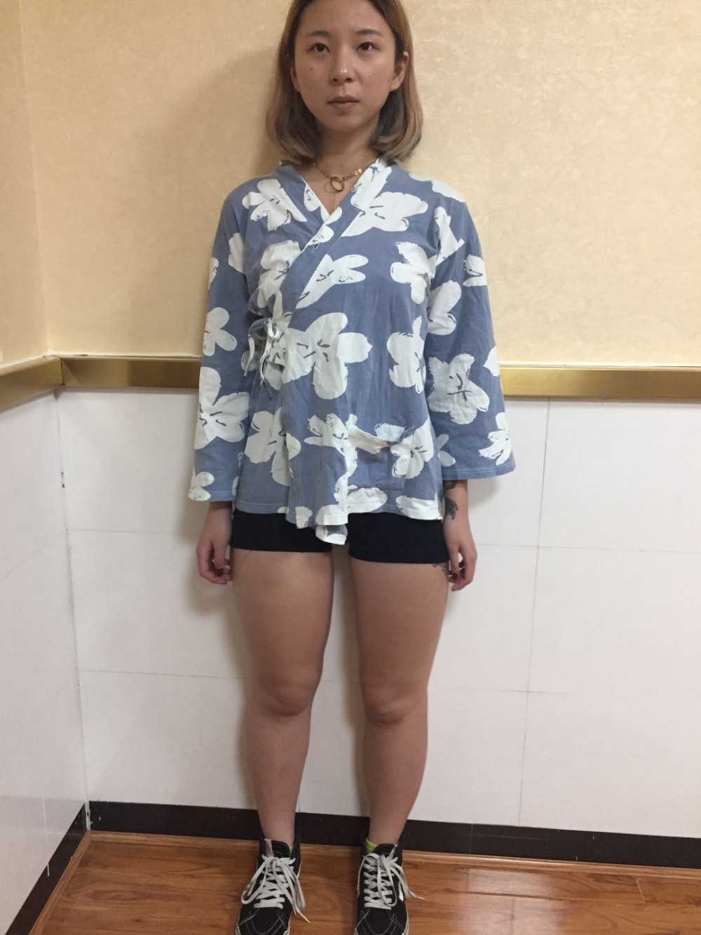 深圳鵬愛醫(yī)療整形醫(yī)生張建文做大腿吸脂怎么樣？附大腿吸脂案例效果對比圖