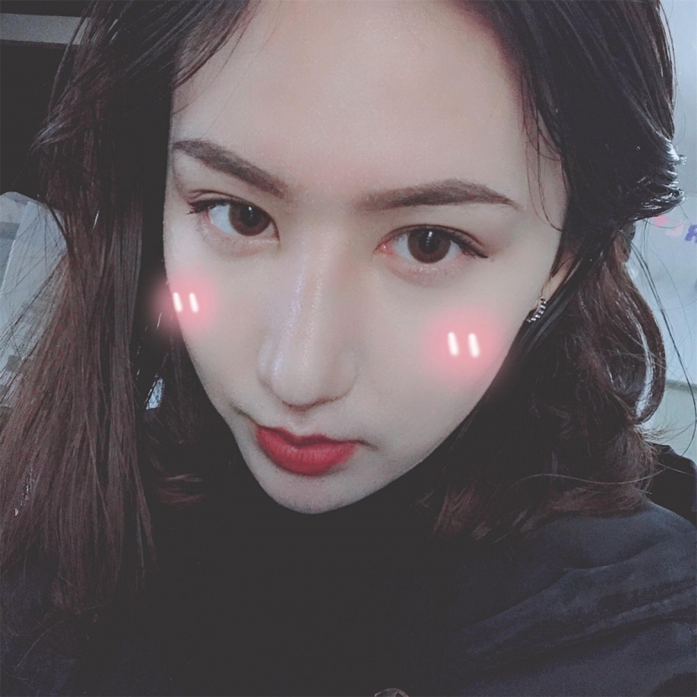 煙臺(tái)洛神醫(yī)學(xué)美容醫(yī)院張瑞允醫(yī)生做硅膠隆鼻怎么樣？附硅膠隆鼻案例