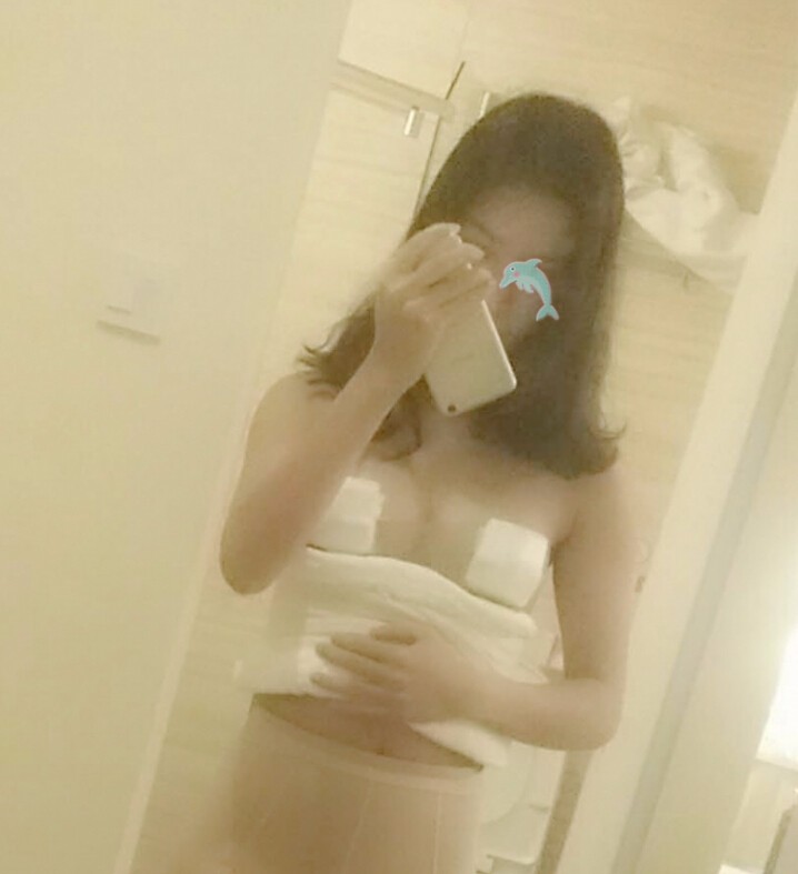 天津怡麗亞韓整形醫(yī)院林海峰醫(yī)生做自體脂肪隆胸真實案例效果對比圖