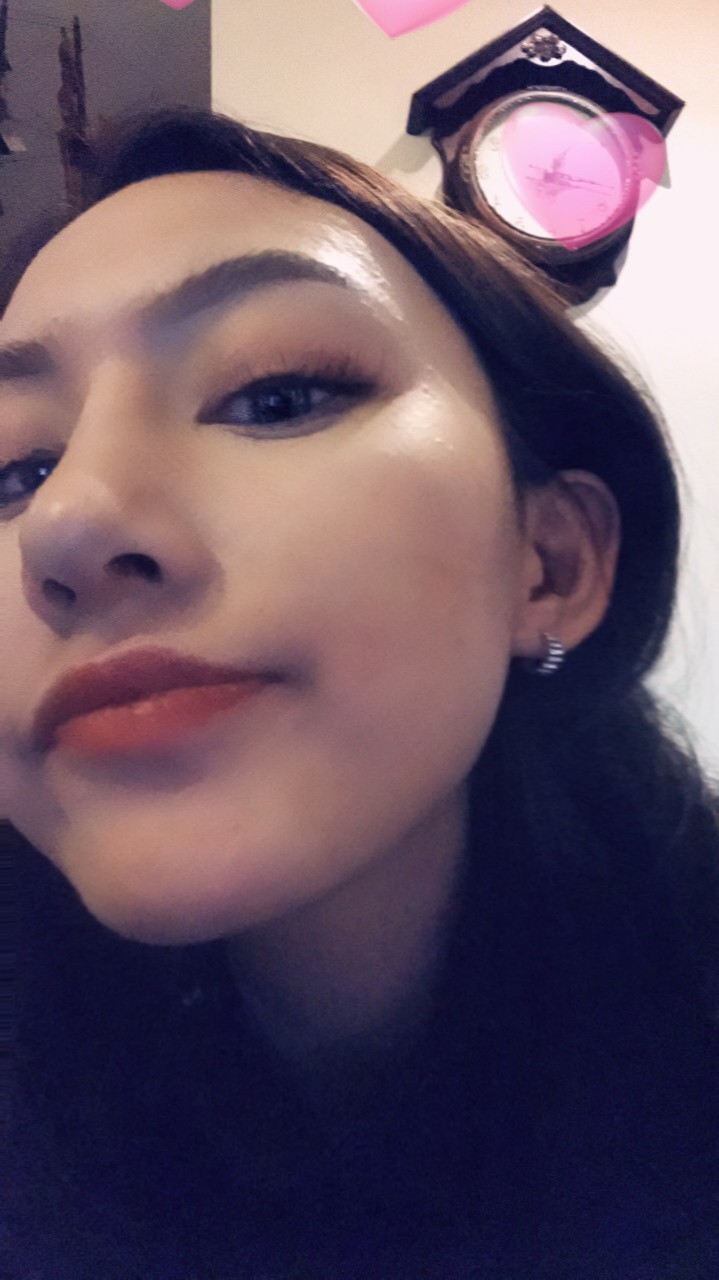 煙臺(tái)洛神醫(yī)學(xué)美容醫(yī)院張瑞允醫(yī)生做硅膠隆鼻怎么樣？附硅膠隆鼻案例