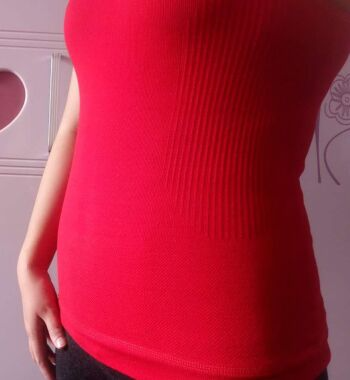 武漢東方麗人醫(yī)院整形美容科胡江偉醫(yī)生做腰腹吸脂案例效果對比圖