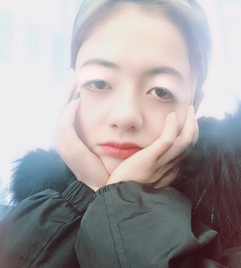 珠海平安康復(fù)醫(yī)院整形美容中心查元坤醫(yī)生面部吸脂案例效果對比圖