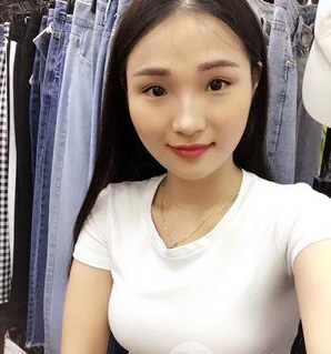 珠海萊茵醫(yī)療美容醫(yī)院崔俊溶醫(yī)生做自體脂肪隆胸效果怎么樣？附自體脂肪隆胸案例