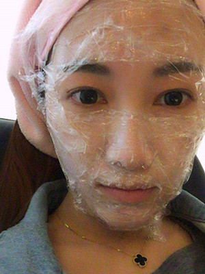 重慶五洲女子醫(yī)院整形美容中心做光子嫩膚怎么樣？淡明斌醫(yī)生光子嫩膚案例