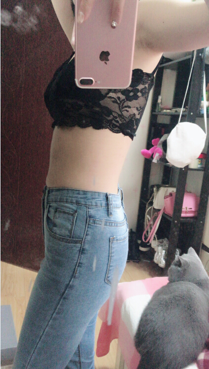 長沙亞韓醫(yī)學(xué)整形醫(yī)生米勒做腰腹吸脂效果怎么樣？米勒腰腹吸脂案例