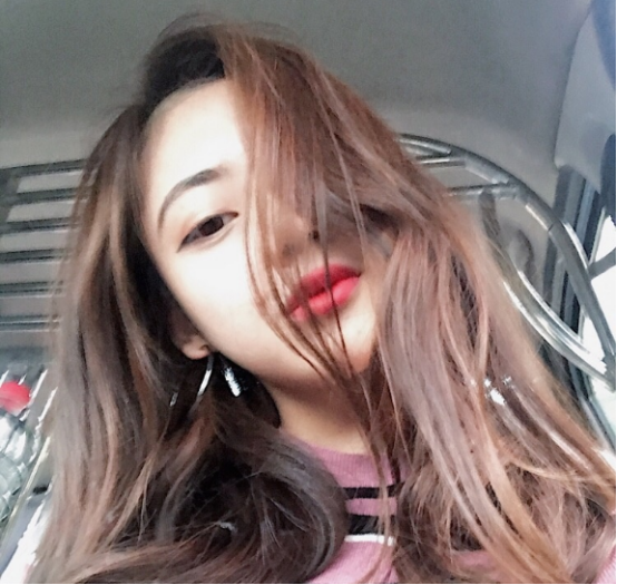 珠海平安康復(fù)醫(yī)院整形美容中心查元坤醫(yī)生面部吸脂案例效果對比圖 珠海平安康復(fù)醫(yī)院整形美容中心查元坤醫(yī)生面部吸脂案例效果對比圖