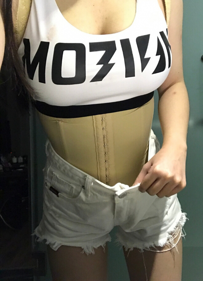 長沙亞韓醫(yī)學(xué)整形醫(yī)生米勒做腰腹吸脂效果怎么樣？米勒腰腹吸脂案例