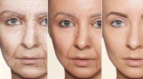 貴陽美和諧整形自體脂肪填充