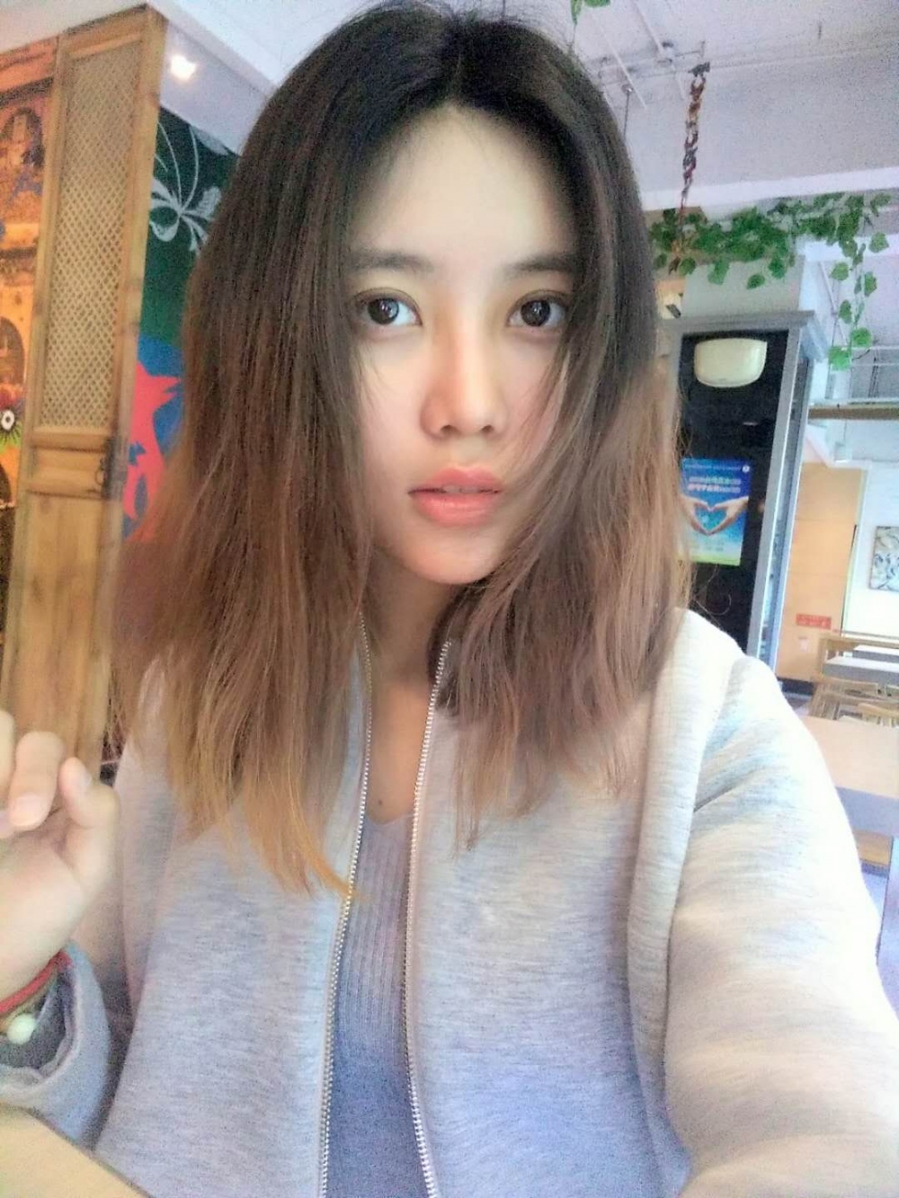 重慶美圣美邦整形醫(yī)院劉力維醫(yī)生做自體脂肪全臉填充案例效果對(duì)比圖