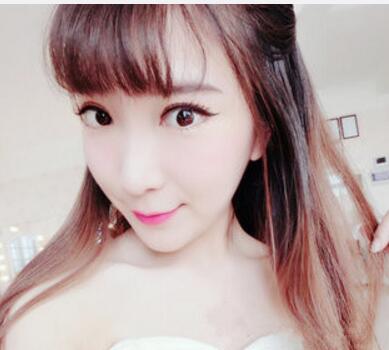 武漢中翰整形外科醫(yī)院陳志鵬醫(yī)生做雙眼皮修復(fù)效果怎么樣？附雙眼皮修復(fù)案例