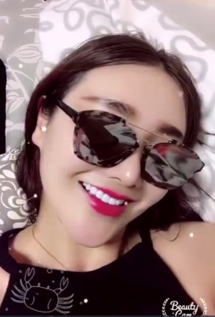 廣州柏德口腔蘭海龍醫(yī)生做瓷貼面效果怎么樣？廣州柏德口腔瓷貼面案例分享