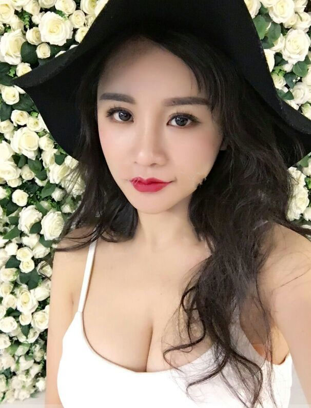 海南韓美醫(yī)學(xué)美容醫(yī)院李強(qiáng)醫(yī)生做自體脂肪隆胸效果怎么樣？附案例