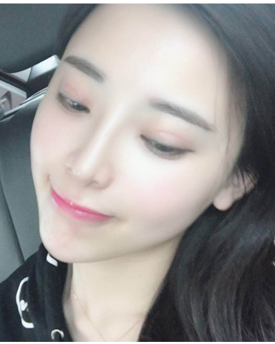 襄陽維多利亞整形醫(yī)院安邰晥醫(yī)生做鼻綜合整形怎么樣？附鼻綜合整形案例