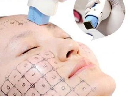 哈爾濱美之術整形熱瑪吉