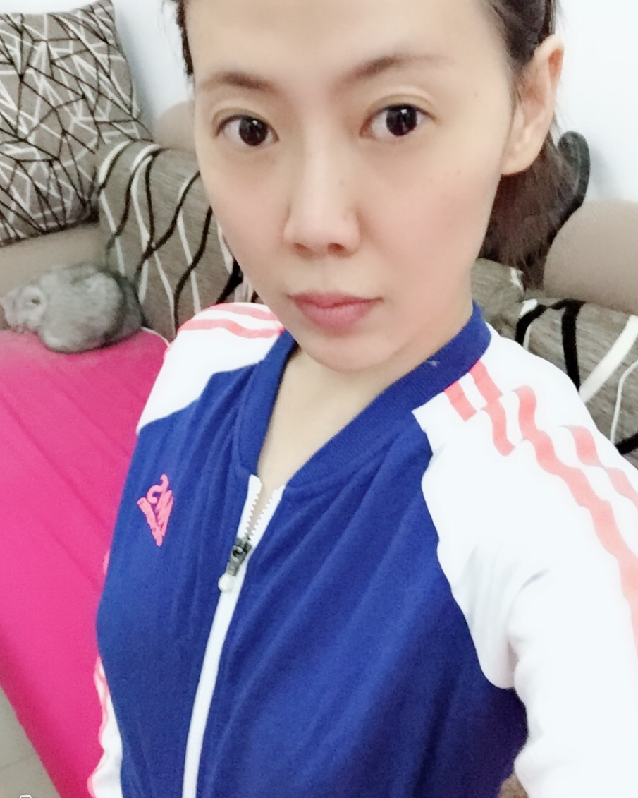 煙臺(tái)壹美整形醫(yī)院朱建瑩醫(yī)生做自體脂肪隆胸怎么樣？附自體脂肪隆胸案例