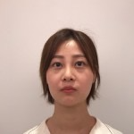 天津歐華威莎整形醫(yī)生姚玲做面部埋線提升效果怎么樣？附埋線提升案例