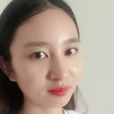 武漢維納斯整形醫(yī)院趙瑾醫(yī)生做玻尿酸墊下巴怎么樣？附玻尿酸墊下巴案例