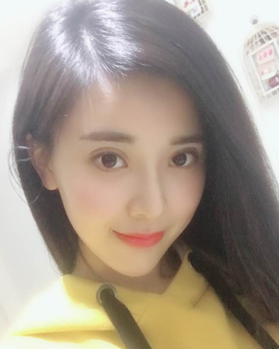 襄陽維多利亞整形醫(yī)院安邰晥醫(yī)生做鼻綜合整形怎么樣？附鼻綜合整形案例