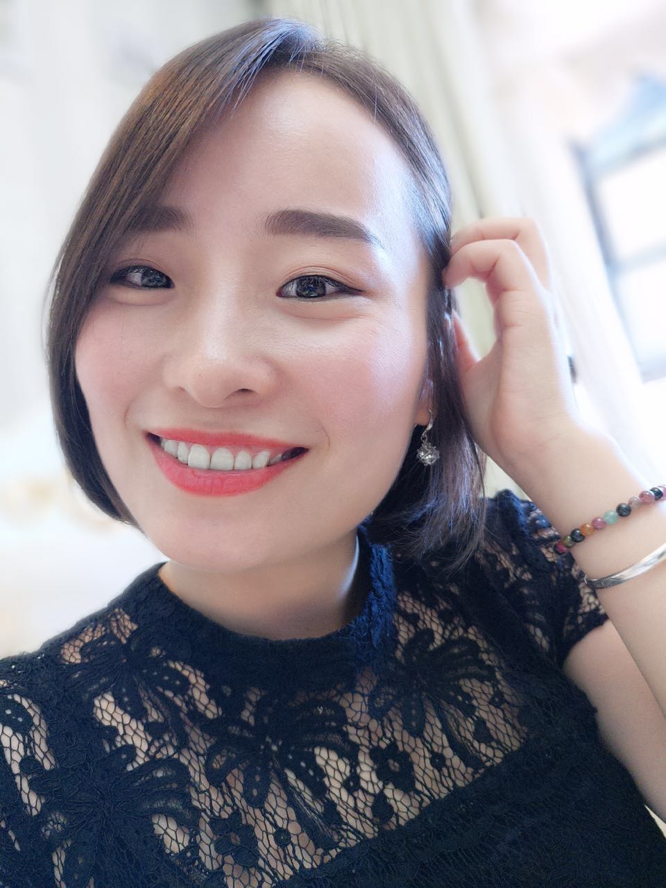 鄭州壹加壹整形醫(yī)院楊永利醫(yī)生做牙齒隱形矯正怎么樣？附牙齒隱形矯正案例